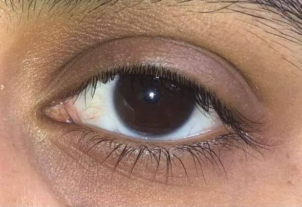 Was Ist Dieser Ring Um Mein Auge Augen Farbe Braun Was Ist Dieser Ring Um Mein Auge Augen Farbe Braun