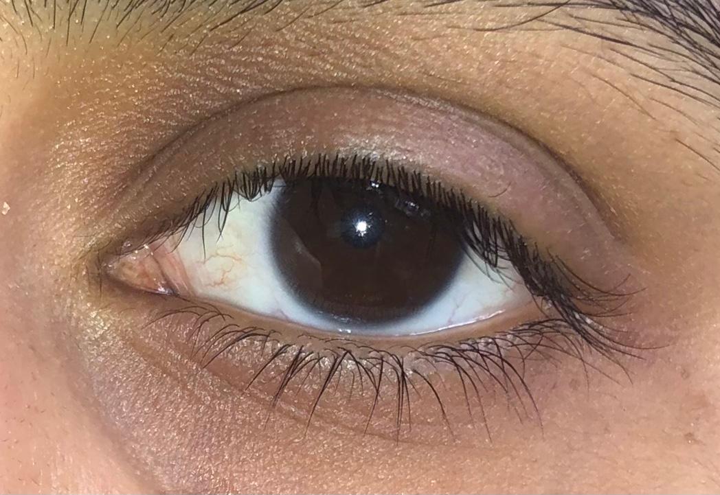Was ist dieser Ring um mein Auge? (Augen, Farbe, braun) Was ist dieser Ring um mein Auge? (Augen, Farbe, braun)