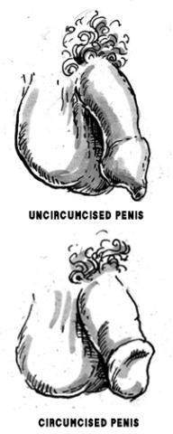 Was ist ein beschnittener Penis?