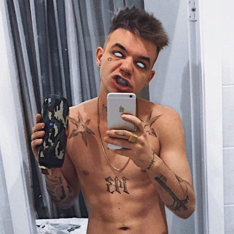 Was Ist Mit Den Augen Von Diesem Russischen Rapper Eldzhej Allj Musik Internet Medizin Was Ist Mit Den Augen Von Diesem Russischen Rapper Eldzhej Allj Musik Internet Medizin