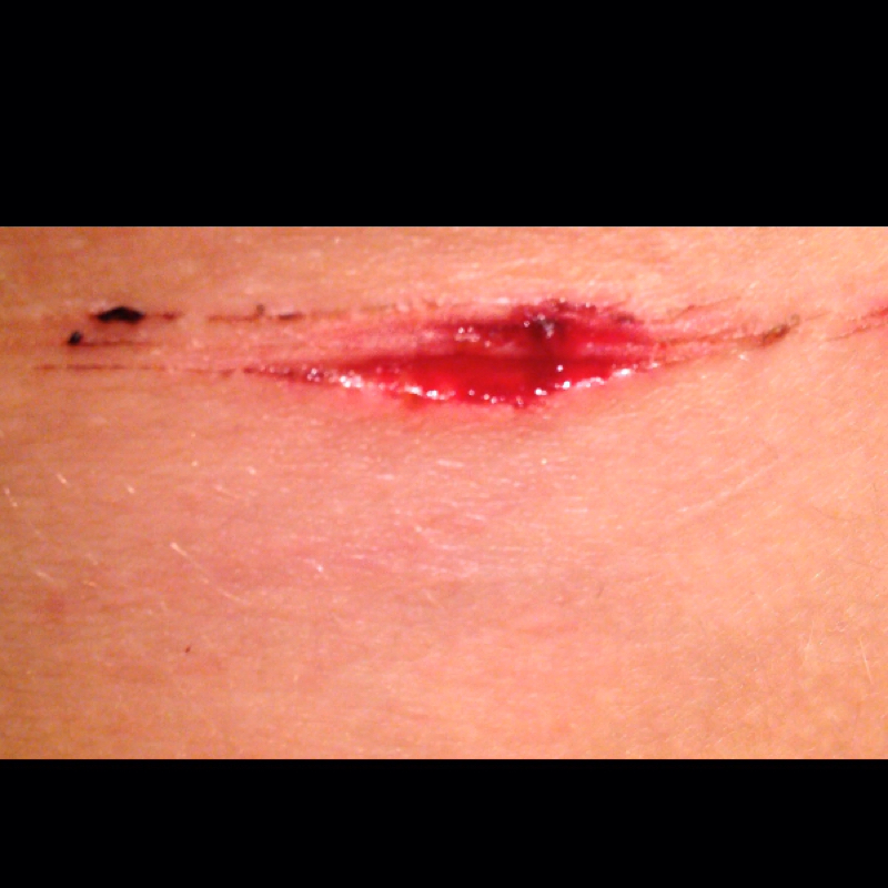 Was ist mit dieser Wunde? Hilfe bitte... (Medizin)