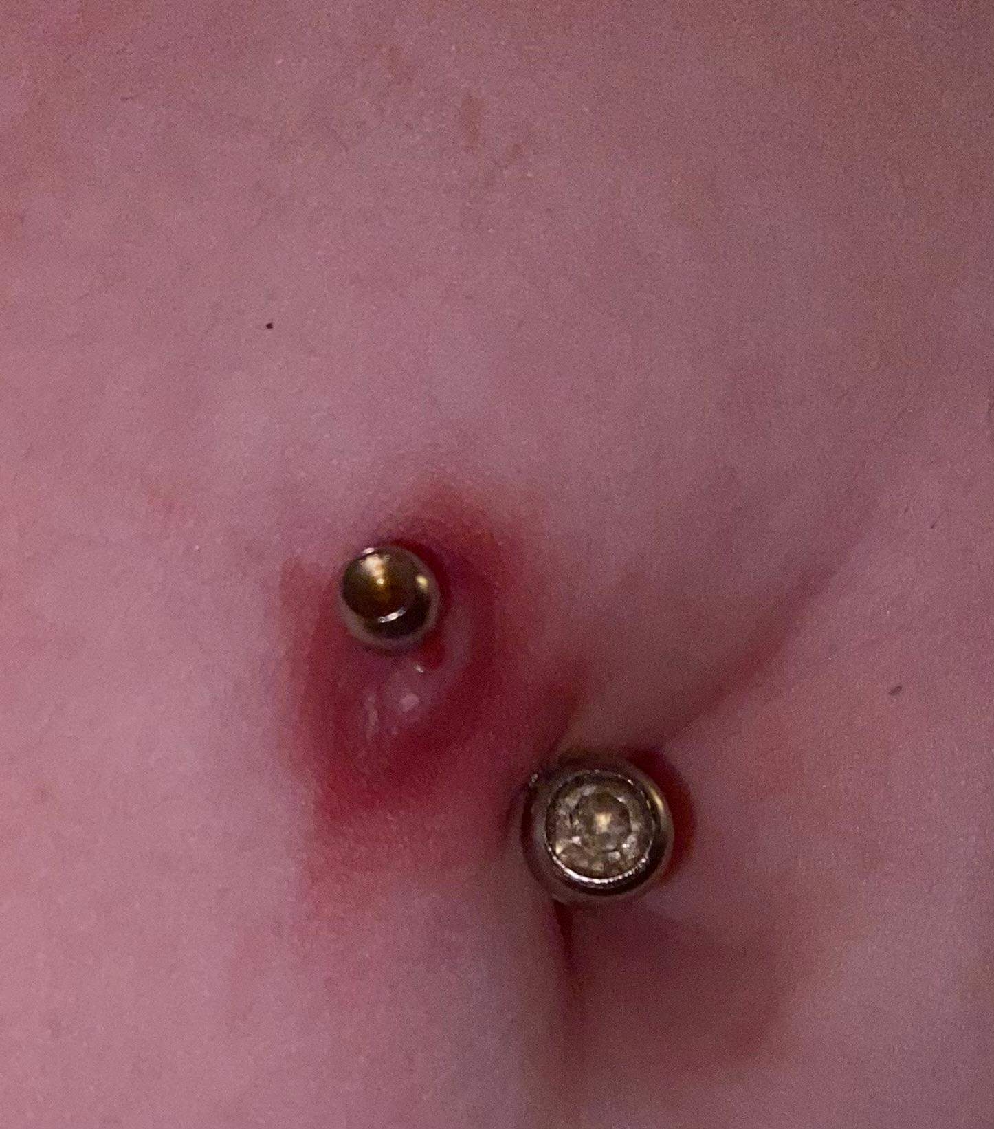 was ist mit mein Bauchnabel Piercing? (Entzündung, Bauchnabelpiercing, Piercingstudio)