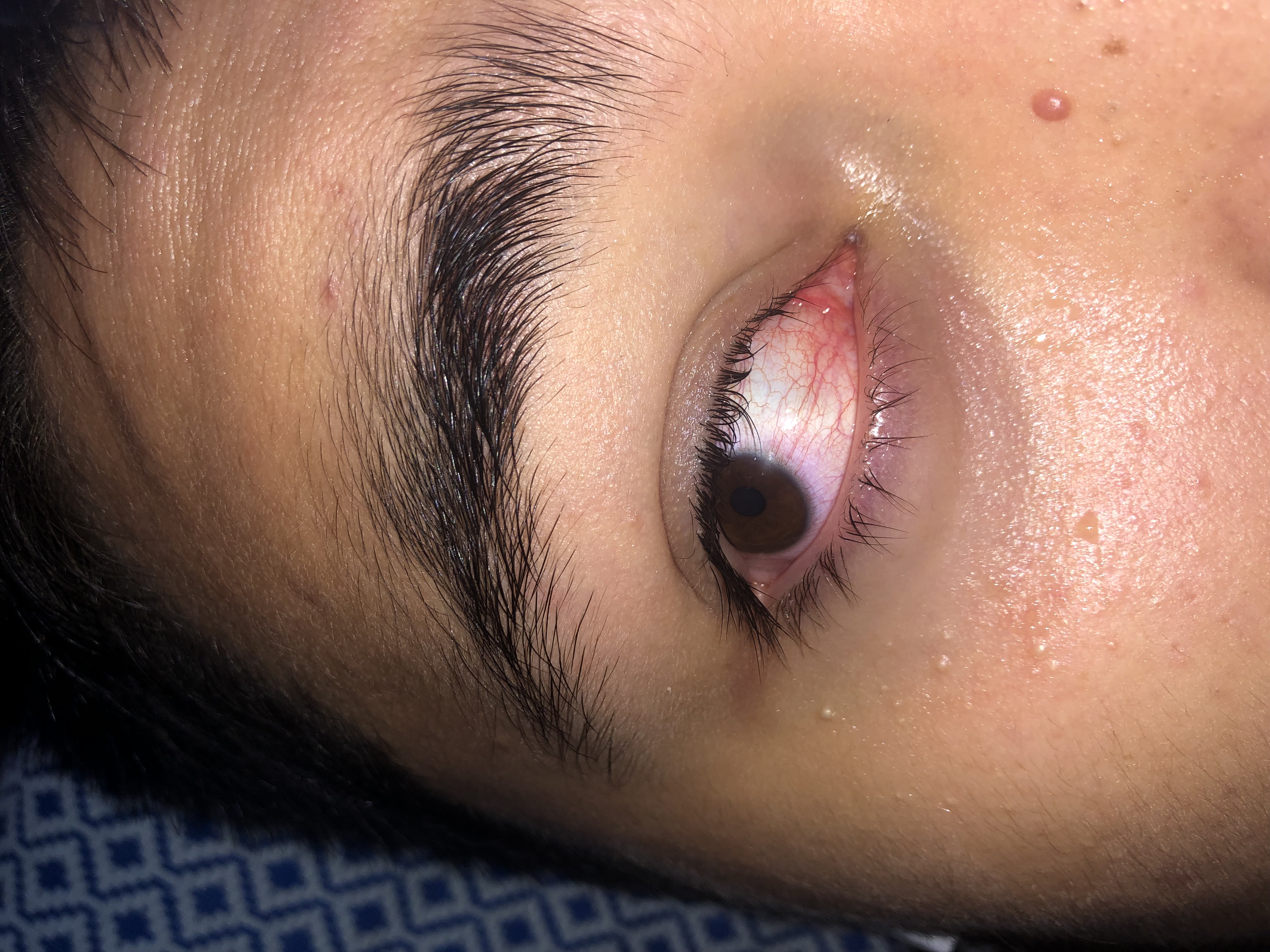 Was ist mit meinem Auge hab am Mittwoch einen Termin beim Augenarzt