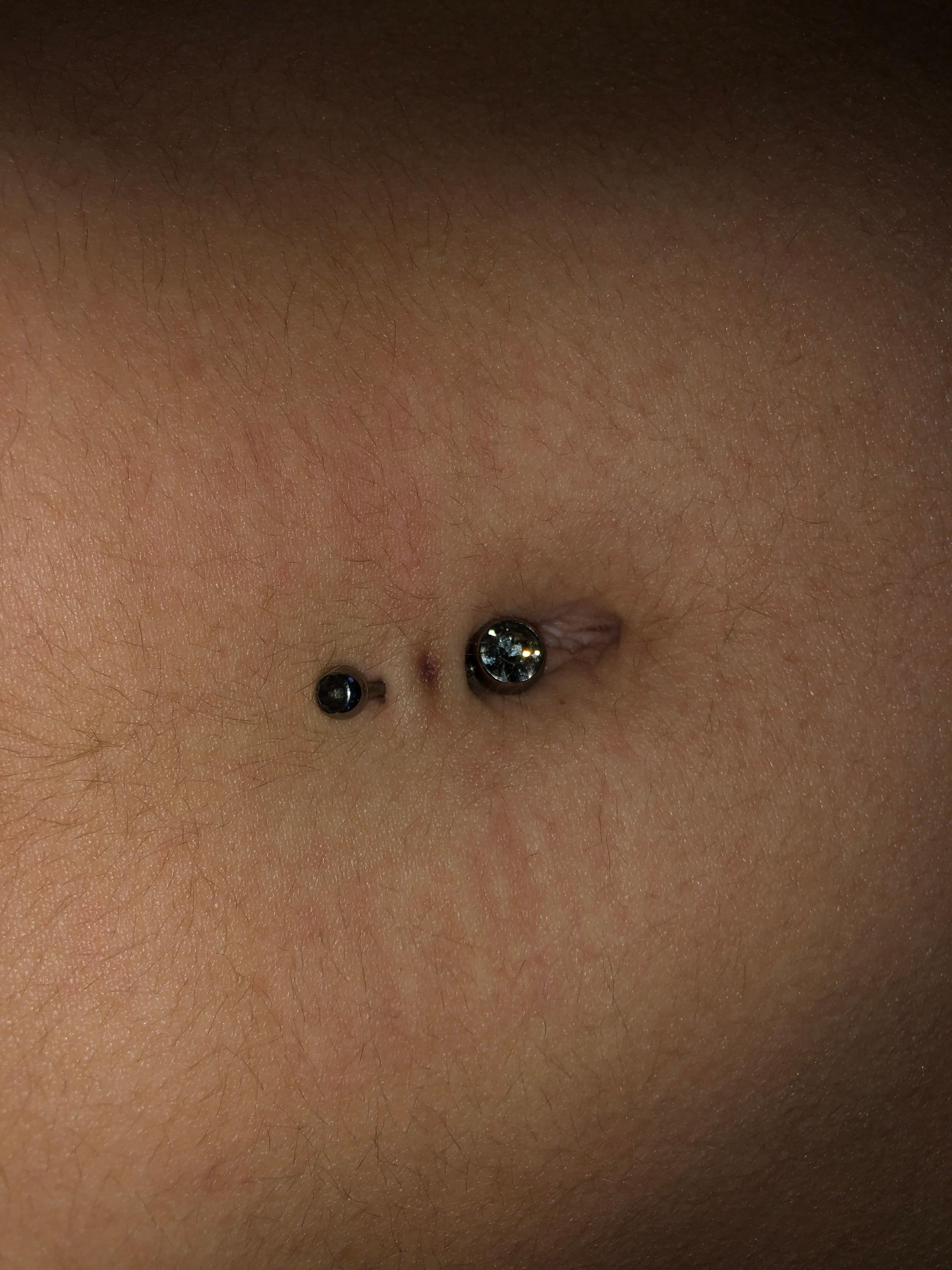 Was ist mit meinem Bauchnabelpiercing los? (Gesundheit und Medizin)