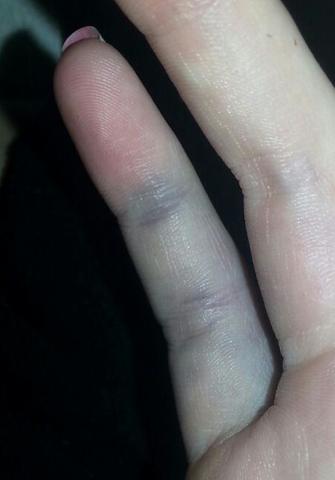 so sieht mein Finger aus - (Finger, blau)