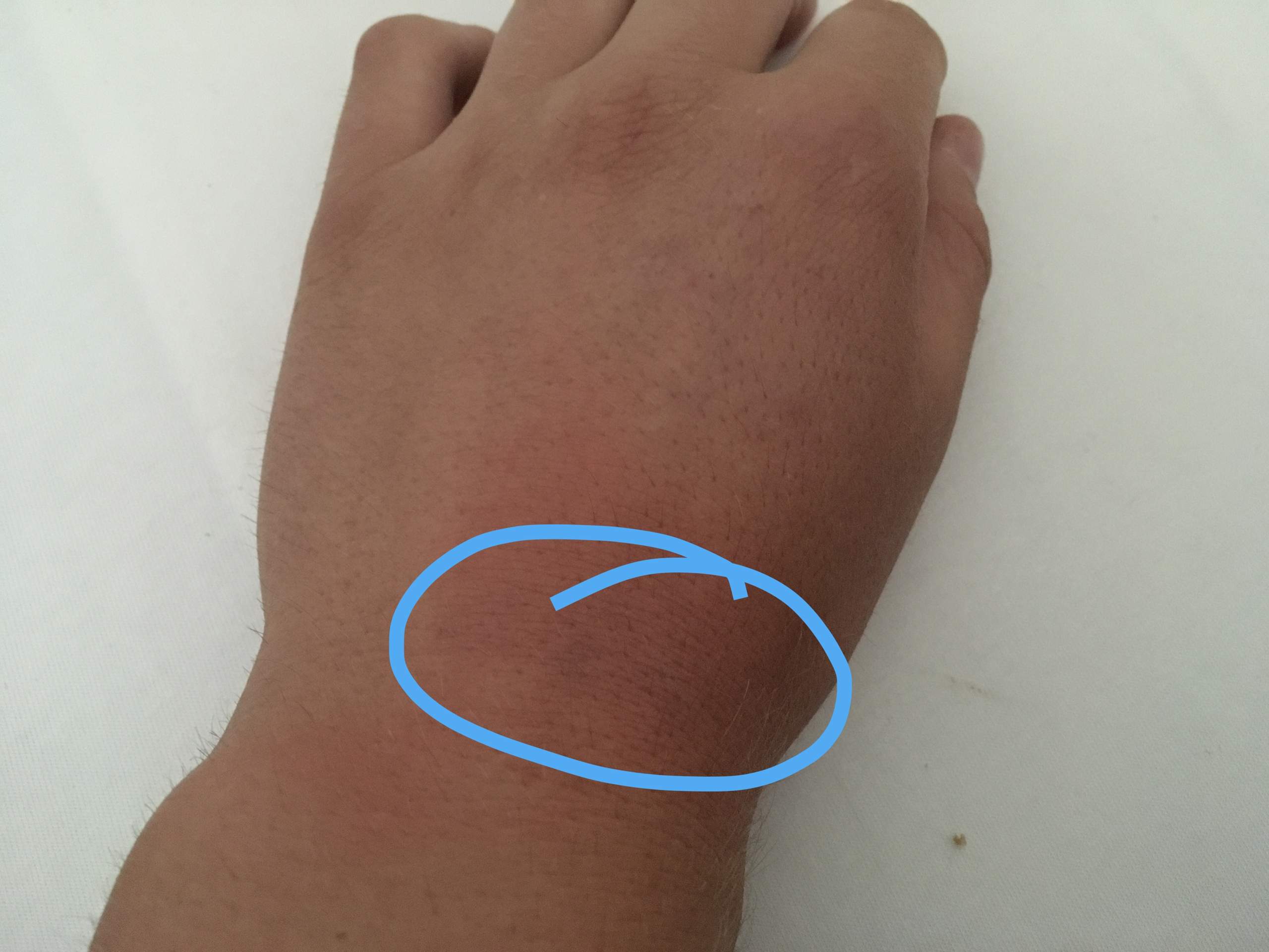 Was ist mit meinem Handgelenkk? (Medizin, Schmerzen, Handgelenk) Was ist mit meinem Handgelenkk? (Medizin, Schmerzen, Handgelenk)