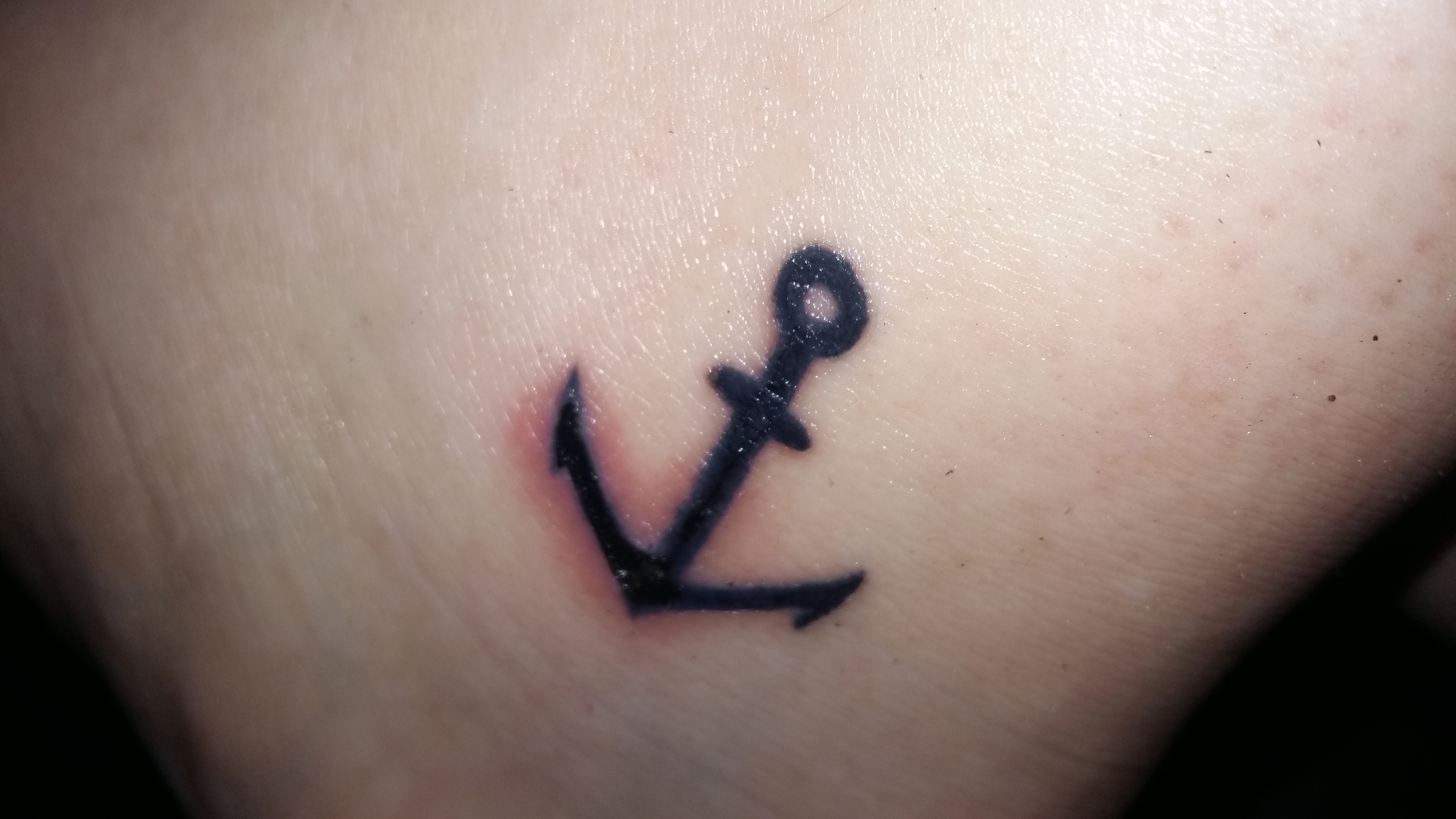 Entzündetes Tattoo Entzündetes Tattoo