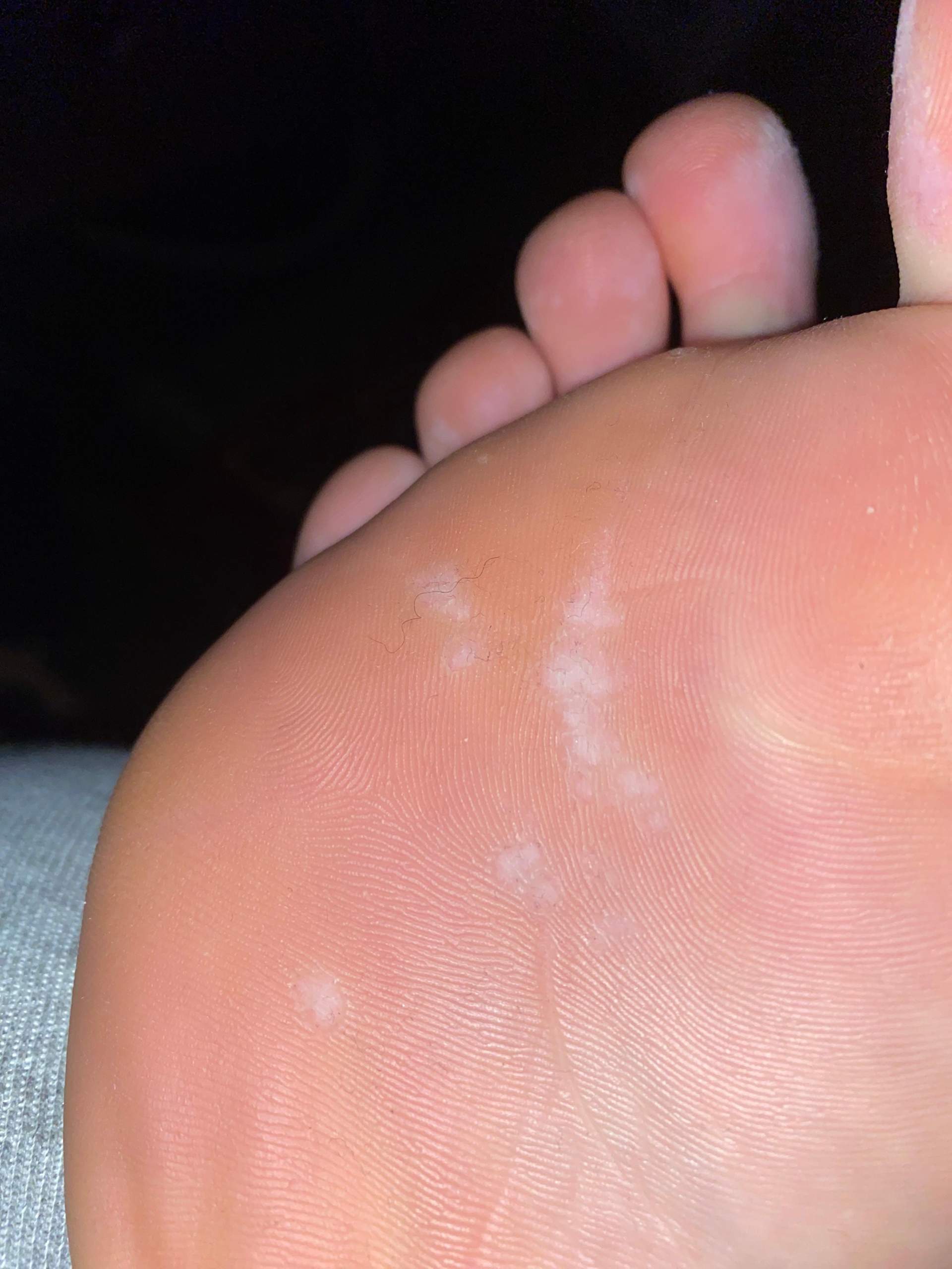 Was ist mit meinen Füßen? (Körper, Haut, Gesicht)