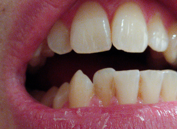 Meine Zähne - (Medizin, Zähne, Zahnarzt)