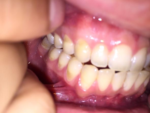 Zähne - (Gesundheit, Zähne, Zahnarzt)