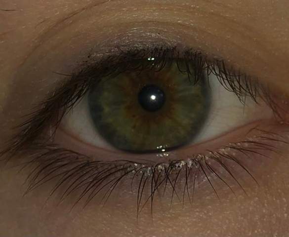 Was ist mit meiner Augenfarbe los?