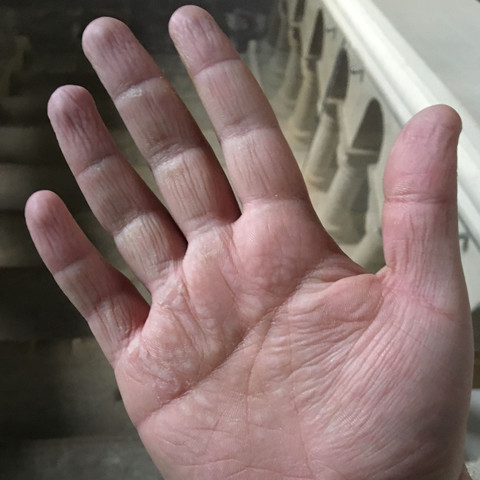 Meine rechte Hand  - (Haut, Hand)