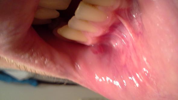 Was Ist Mit Meiner Lippe Los Entzundet