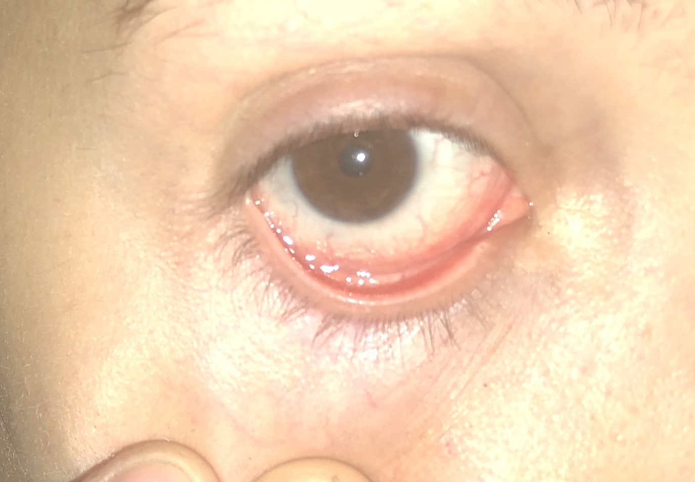 Was Kann Das Sein Am Im Auge Gesundheit Und Medizin Augen Augenarzt 