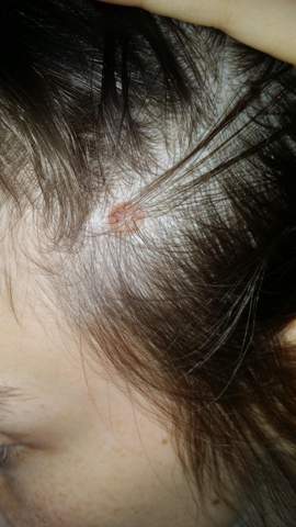 Was Kann Das Sein Am Kopf Es Ist Dick War Aber Schon Immer Dick Und Gross Nur Die Farbe Weiss Ich Nicht Kann Das Schlimm Sein Nach Was Sieht Das Aus Gesundheit Was Kann Das Sein Am Kopf Es Ist Dick War Aber Schon Immer Dick Und Gross Nur Die Farbe Weiss Ich Nicht Kann Das Schlimm Sein Nach Was Sieht Das Aus Gesundheit