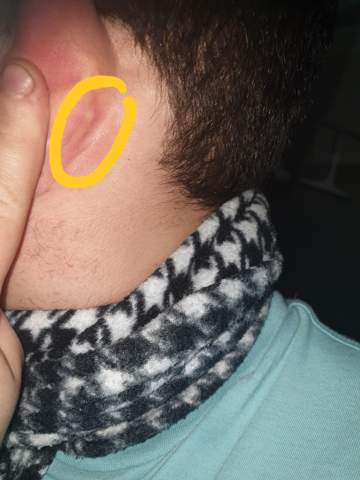 Was Kann Das Sein Am Ohr Gesundheit Was Kann Das Sein Am Ohr Gesundheit