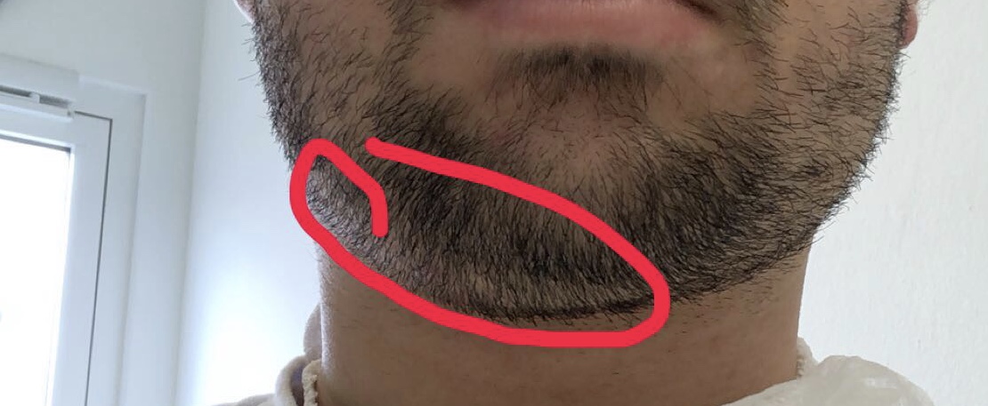 Was kann das sein, habe es seit gestern bemerkt jetzt tut Was kann das sein, habe es seit gestern bemerkt jetzt tut