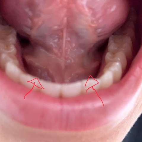 Was Kann Das Sein Mit Einem Bild Zunge Speichel Was Kann Das Sein Mit Einem Bild Zunge Speichel