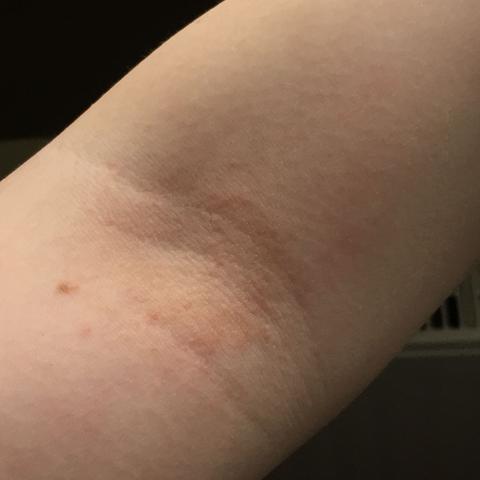 Arm links - (Ausschlag)