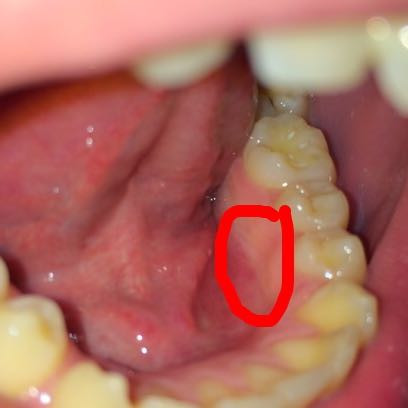 Was Kann Dass Denn Sein Unter Dem Mund Zunge Was Kann Dass Denn Sein Unter Dem Mund Zunge