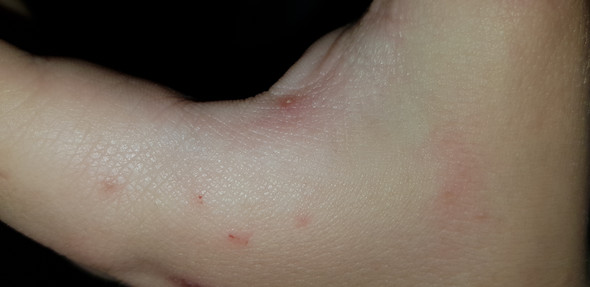 Was Kann Dass Sein Scabis Arzt Was Kann Dass Sein Scabis Arzt