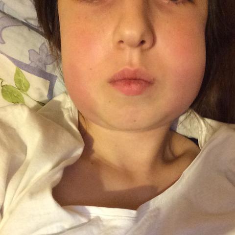 Was Kann Ich Alles Essen Weisheitszahne Sind Raus Schmerzen Weisheitszahn Was Kann Ich Alles Essen Weisheitszahne Sind Raus Schmerzen Weisheitszahn