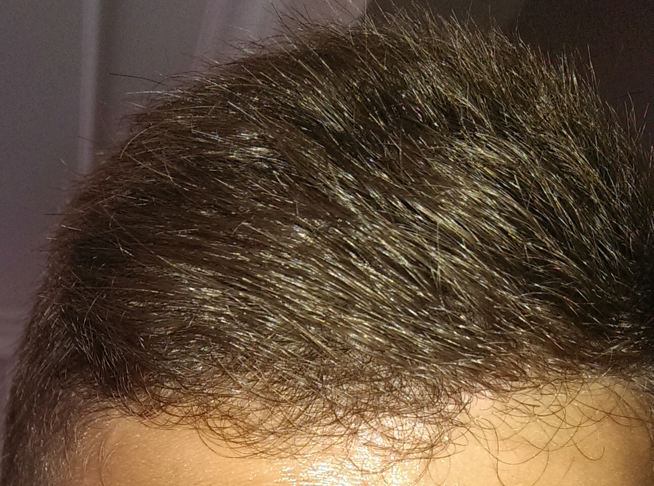 Was kann ich gegen diese Haare machen!? (kaputt, Shampoo, fön)