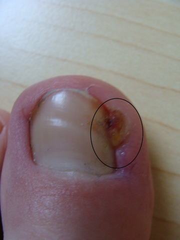 Ich will zu nagel Ich will zu nagel