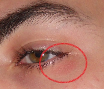 Was Kann Ich Gegen Mein Gerotetes Und Leicht Schuppiges Untere Augenlid Tun Bildet Sich Diese Hautirrtiation Wieder Selbststandig Und Normal Zuruck Gesundheit Haut Kochen