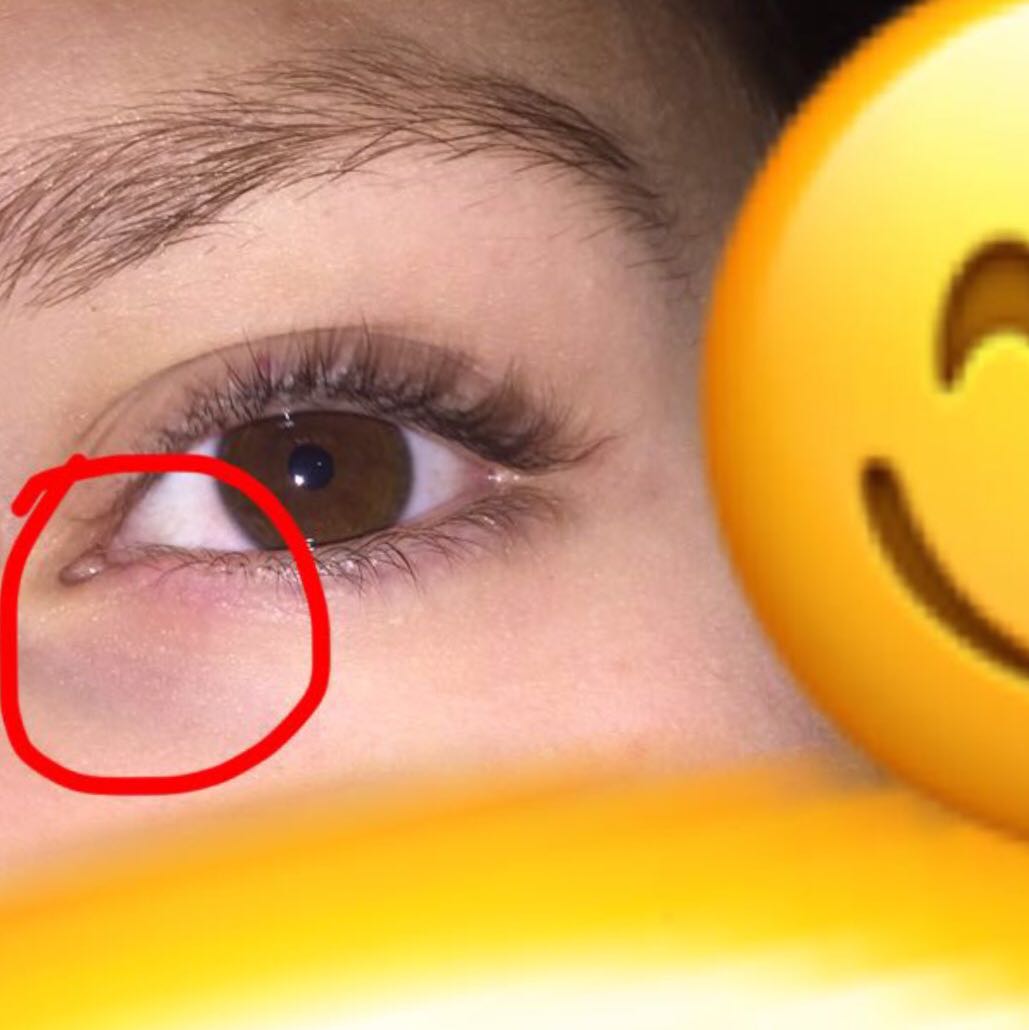 Was Kann Ich Gegen Meine Augenschmerzen Tuen Gesundheit Korper Arzt Was Kann Ich Gegen Meine Augenschmerzen Tuen Gesundheit Korper Arzt