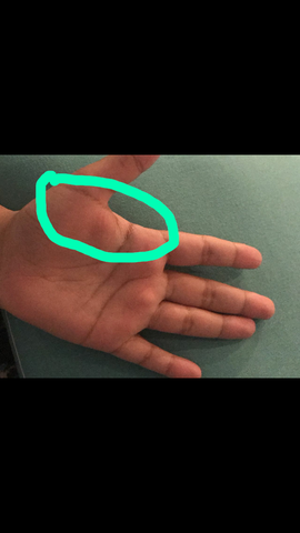 etwa hier an der Stelle - (Gesundheit und Medizin, linke Hand, Brennen von innen)
