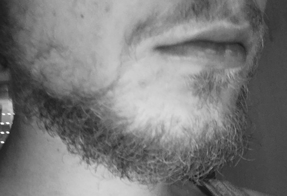 Was kann man aus diesem Bart machen, das es ordentlicher aussieht? (Frisur) - 0 Big Was kann man aus diesem Bart machen, das es ordentlicher aussieht? (Frisur) - 0 Big