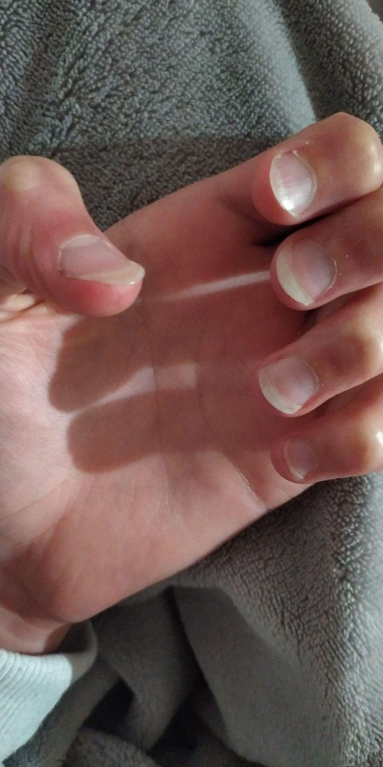 Was kann man gegen breite Ngel machen? (Mdchen, Frauen, Krper)