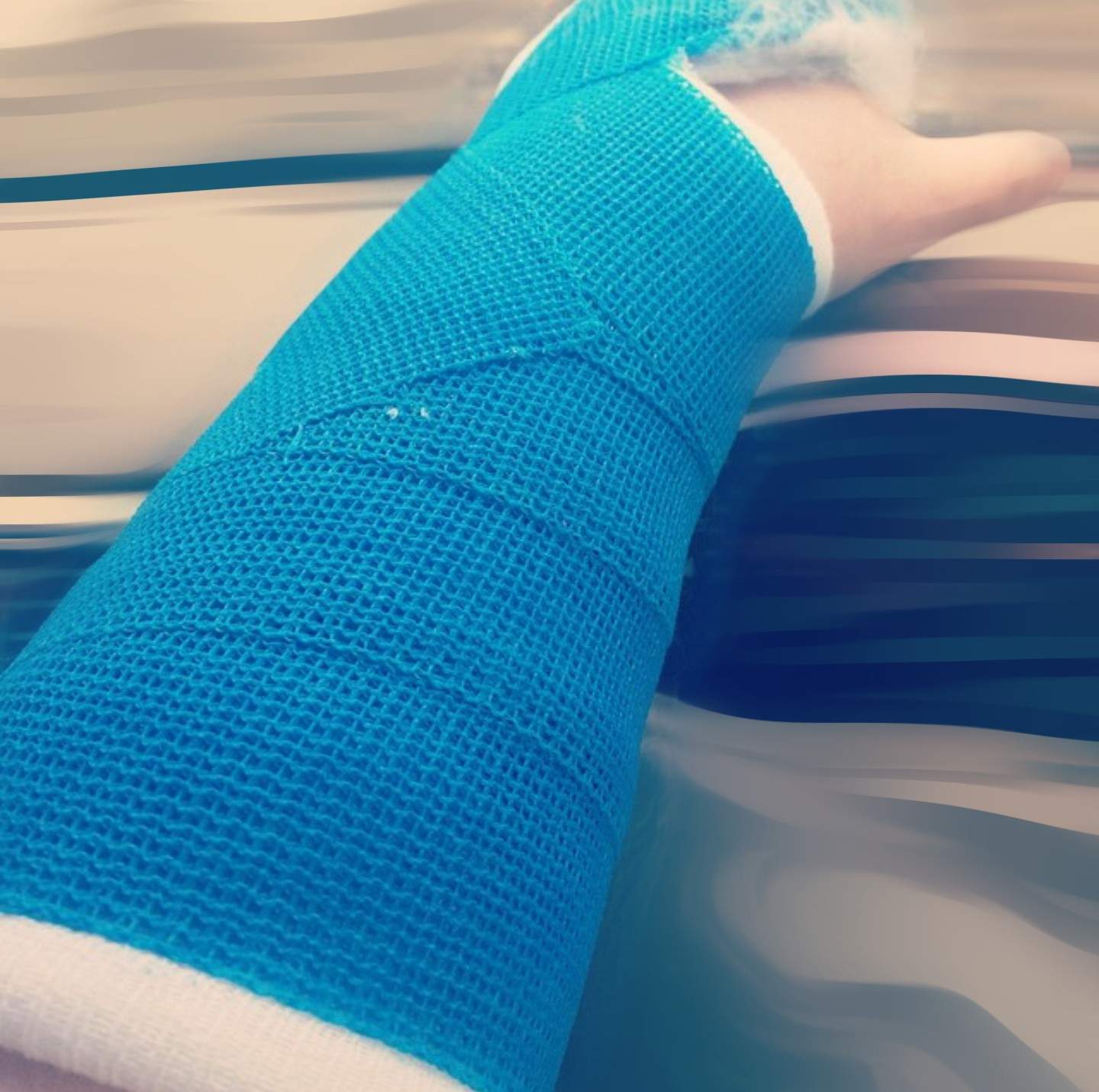 Gipsarm Juckt Ist Das Normal? – Dich unter deinem Gips kratzen – EOKGN