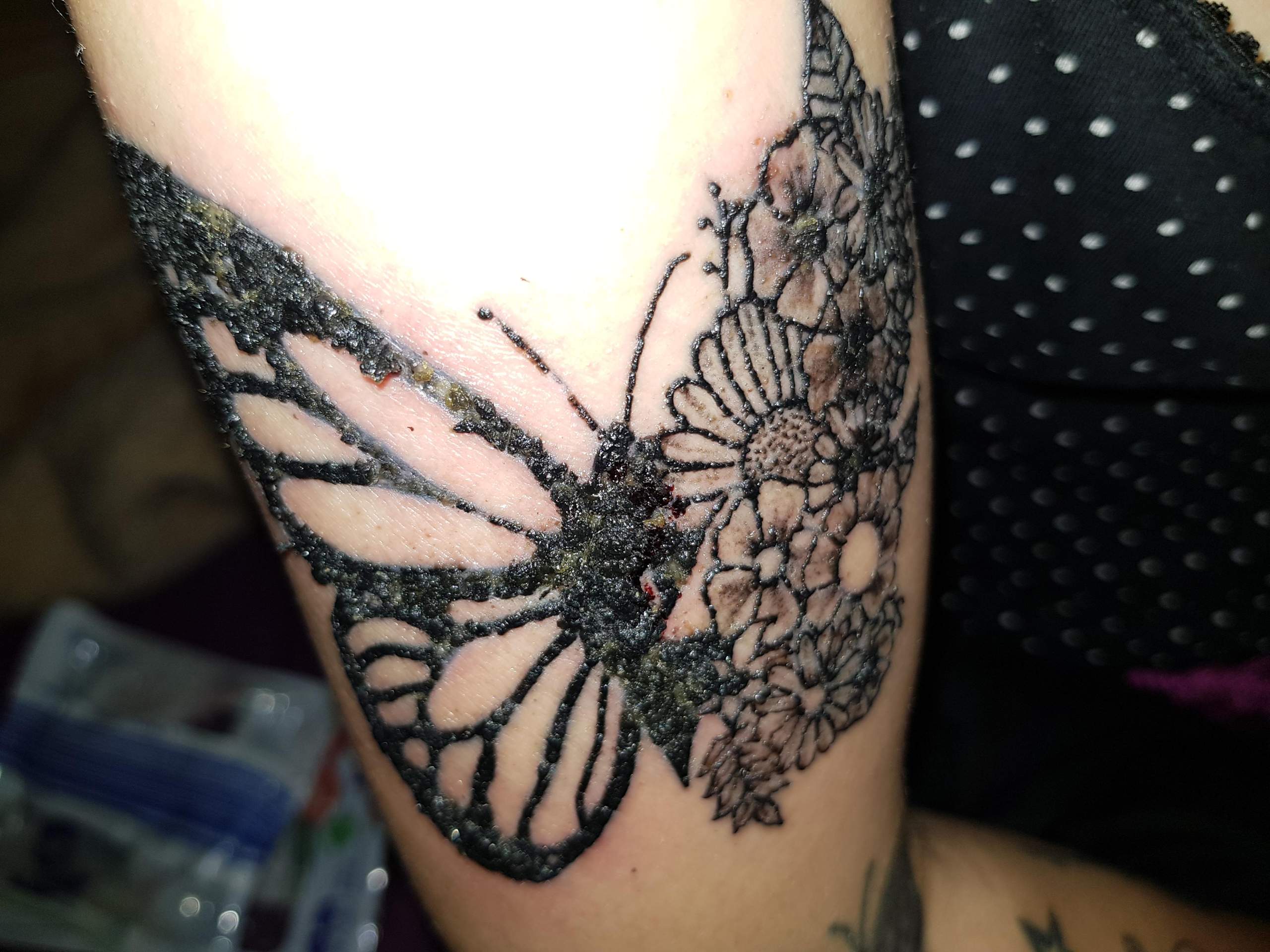 Was Kann Man Tun Das Ein Entzundetes Tattoo Besser Schneller Heilt Gesundheit Und Medizin Was Kann Man Tun Das Ein Entzundetes Tattoo Besser Schneller Heilt Gesundheit Und Medizin