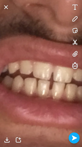 Meine Zähne - (Gesundheit, Zähne)
