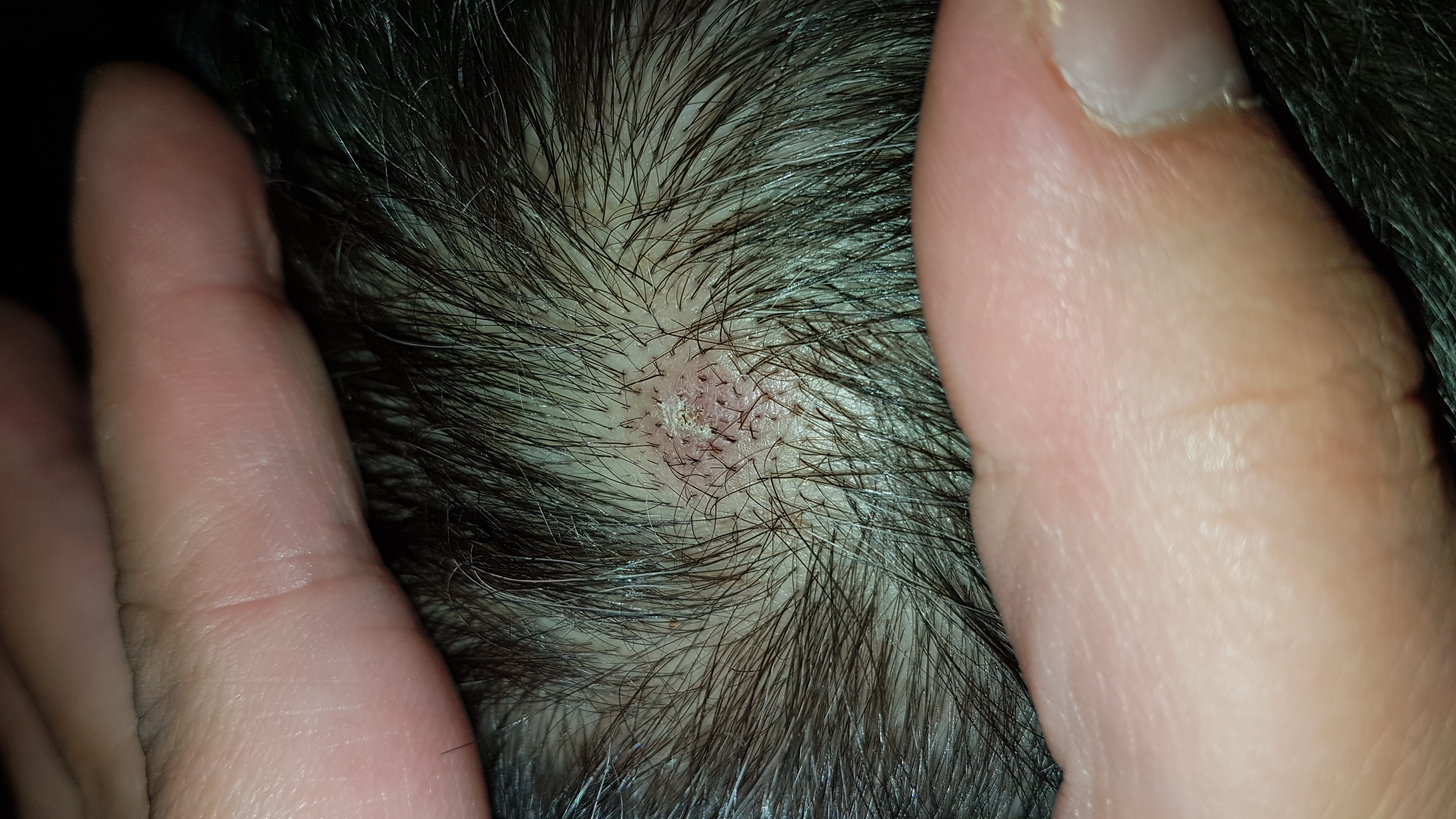 rizinusöl auf kopfhaut