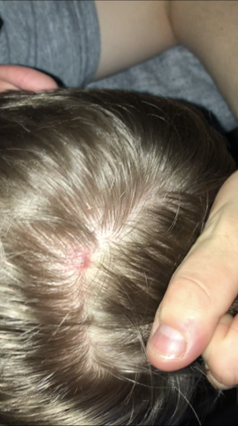 Was Konnte Das Auf Meiner Kopfhaut Sein Gesundheit Und Medizin Gesundheit Haare Was Konnte Das Auf Meiner Kopfhaut Sein Gesundheit Und Medizin Gesundheit Haare