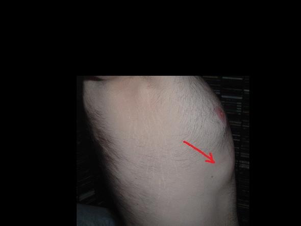 Was Konnte Das Sein Unter Meiner Brust Medizin Korper Rippen Was Konnte Das Sein Unter Meiner Brust Medizin Korper Rippen