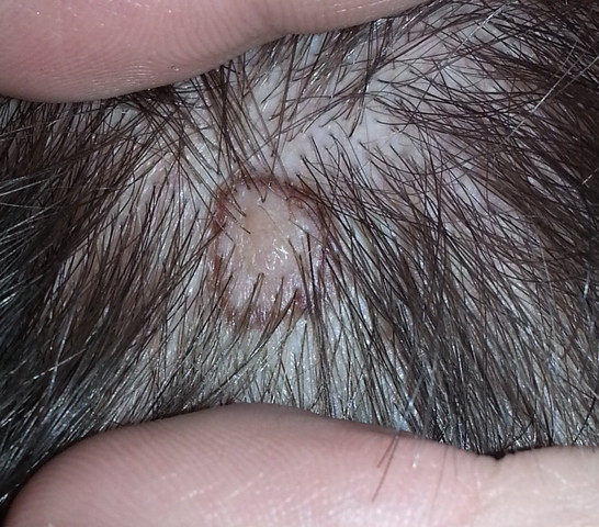 Was Konnte Dieser Hautausschlag Sein Gesundheit Medizin Korper Was Konnte Dieser Hautausschlag Sein Gesundheit Medizin Korper