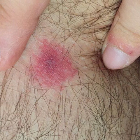 Hier das Bild dazu. - (Gesundheit, Medizin, Arzt)