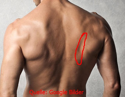 Die Prellung an meinem Rücken. Quelle Google, selbst eingezeichnet - (Sport, Unfall, Rücken)