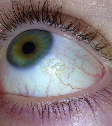 Was könnten diese Bläschen sein? (Gesundheit, Arzt)