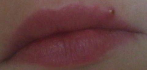 meine lippe  - (Pickel, Lippe)