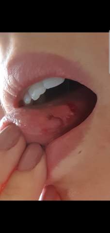 Was Meint Ihr Wachst Das Wieder Dran Gesundheit Und Medizin Gesundheit Medizin Was Meint Ihr Wachst Das Wieder Dran Gesundheit Und Medizin Gesundheit Medizin