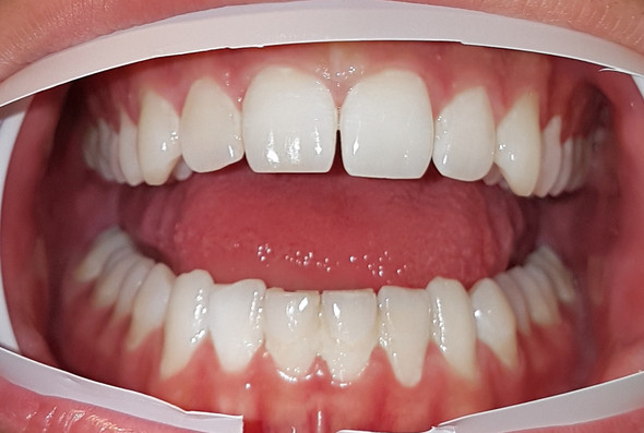 Zähne  - (Gesundheit und Medizin, Zähne, Zahnarzt)