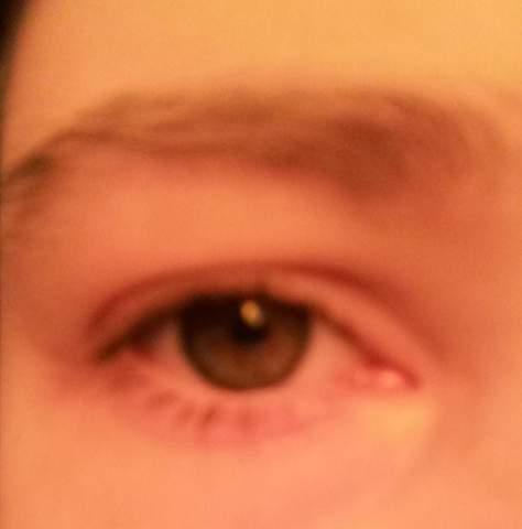 Was Seht Ihr In Diesem Auge Psychologie Augen