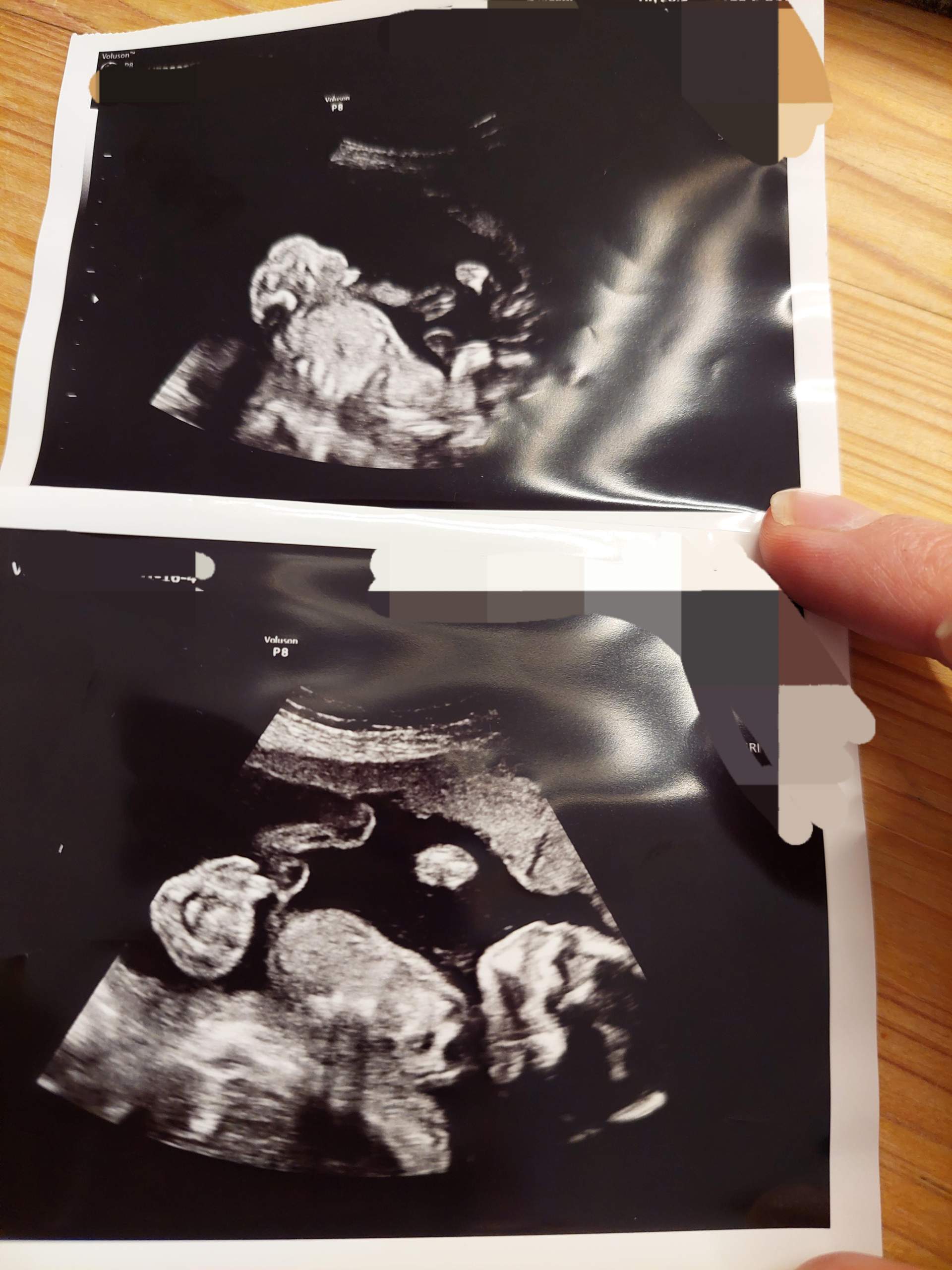 Was seht ihr junge oder mädchen? (Jungs, Schwangerschaft, Wunder)