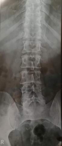 Was Sieht Man Auf Dieser Rontgenaufnahme Gesundheit Und Medizin Rontgenbild Was Sieht Man Auf Dieser Rontgenaufnahme Gesundheit Und Medizin Rontgenbild