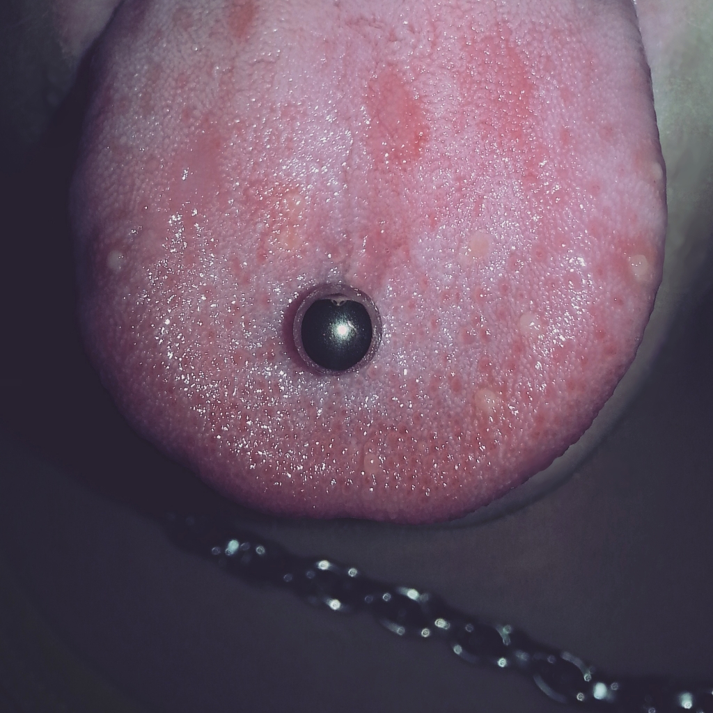 Get Pickel Auf Der Zunge Ausdrücken Gif